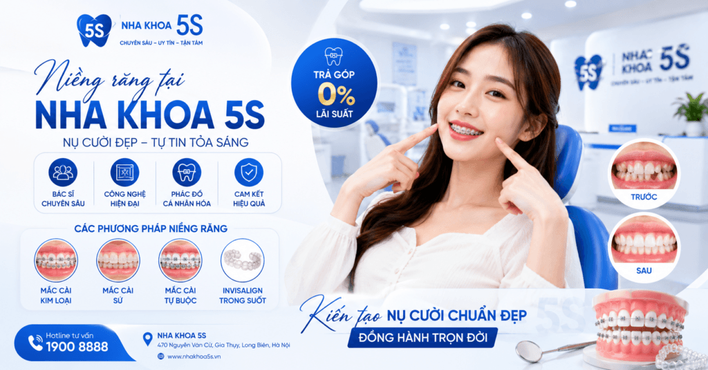 Bảng Giá Niềng Răng Đẹp