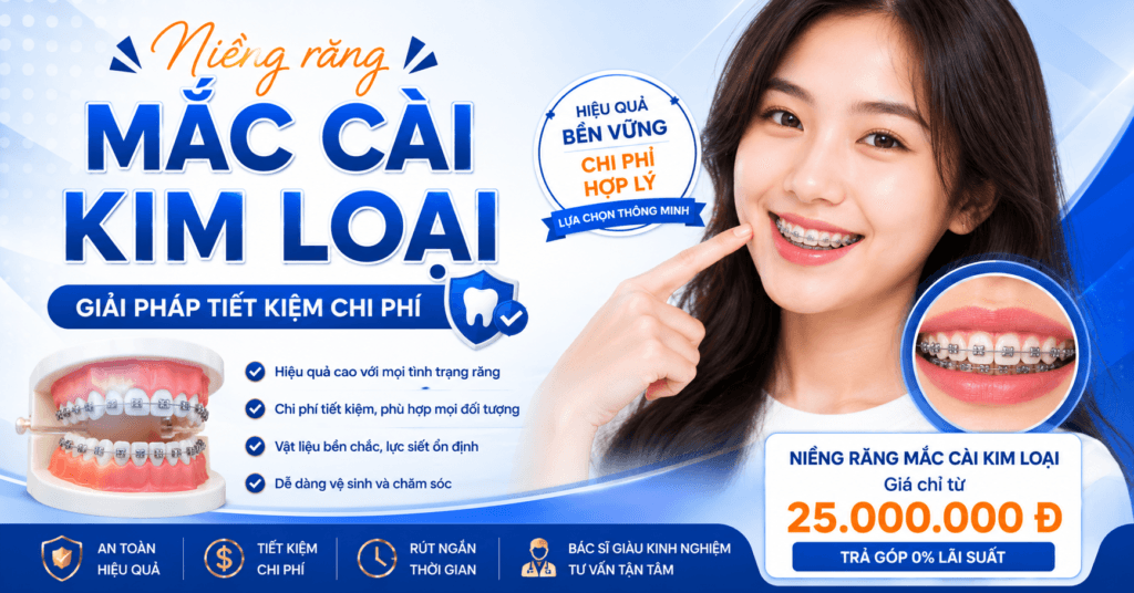 bảng giá niềng răng uy tín