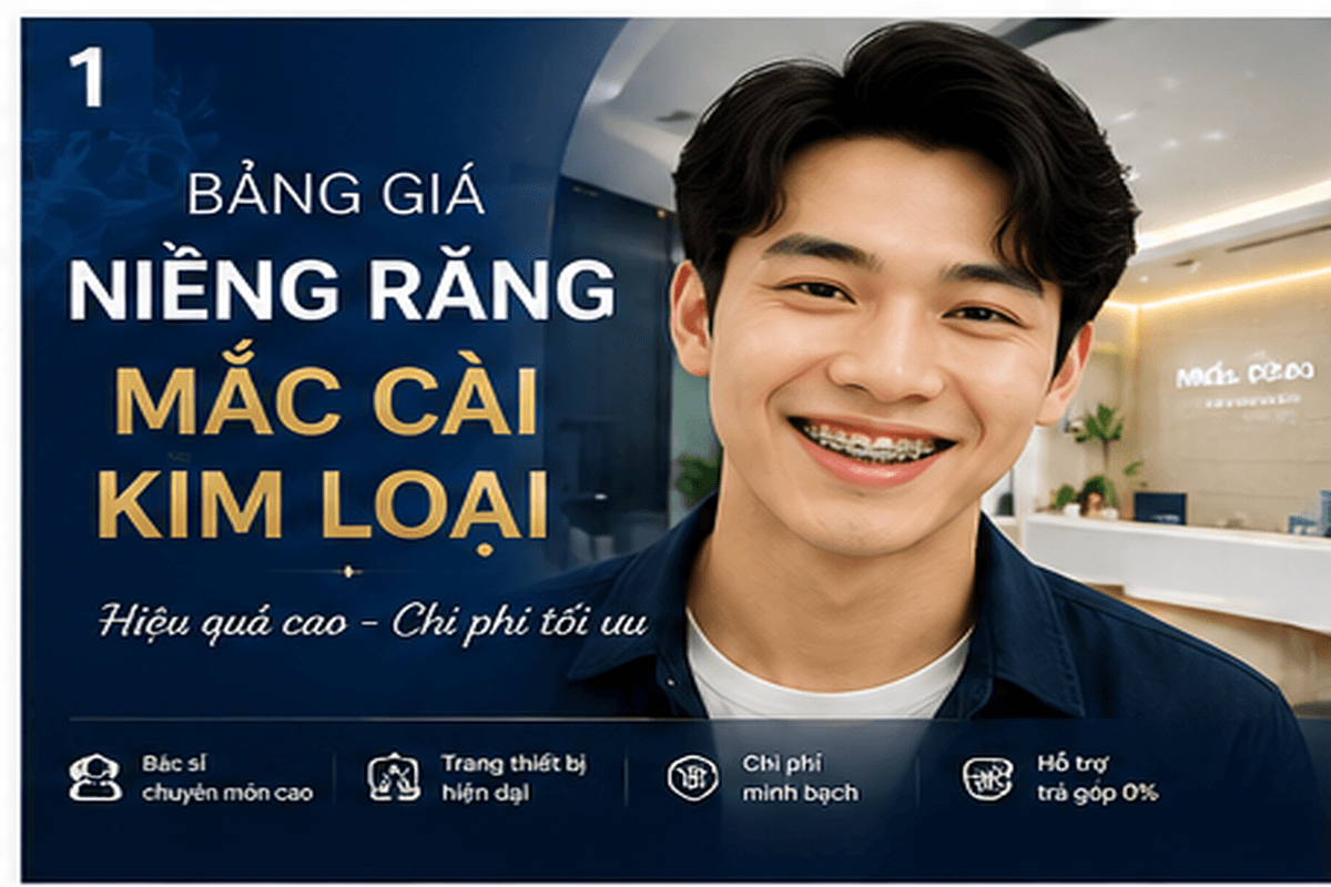 Bảng giá niềng răng mắc cài kim loại