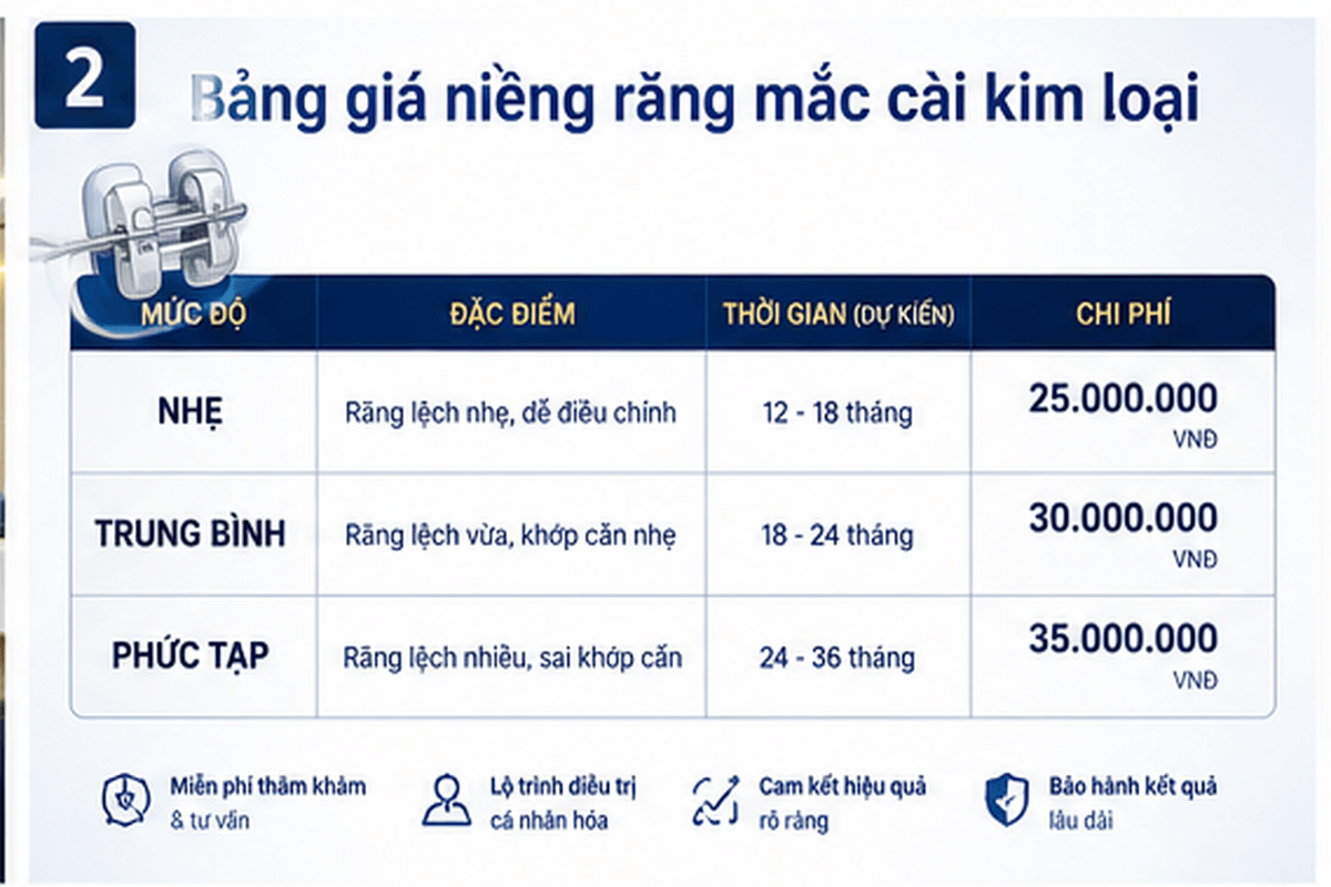 Bảng giá niềng răng mắc cài kim loại