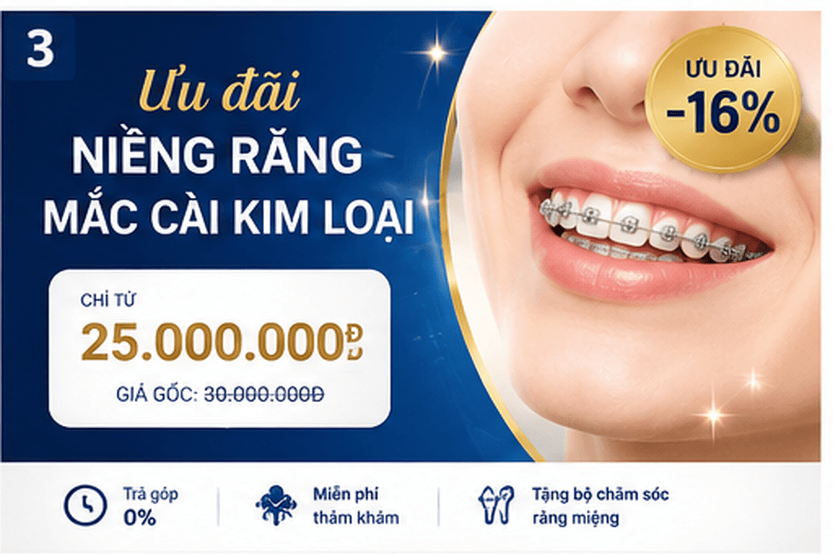 Bảng giá niềng răng mắc cài kim loại