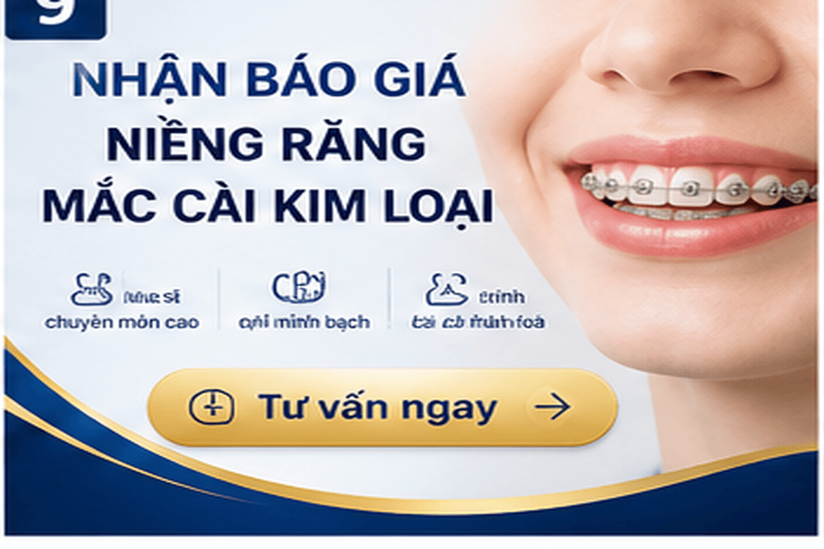 Bảng giá niềng răng mắc cài kim loại