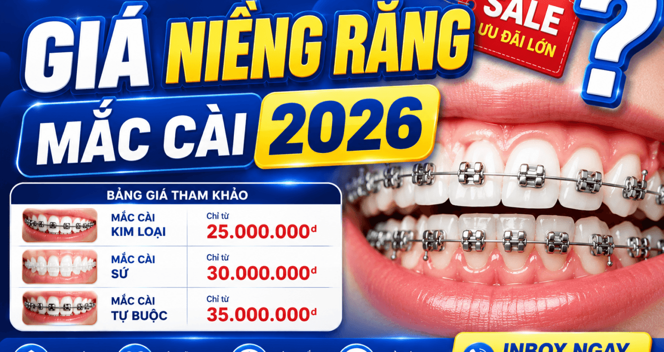 BẢNG GIÁ NIỀNG RĂNG MỚI NHẤT 2026