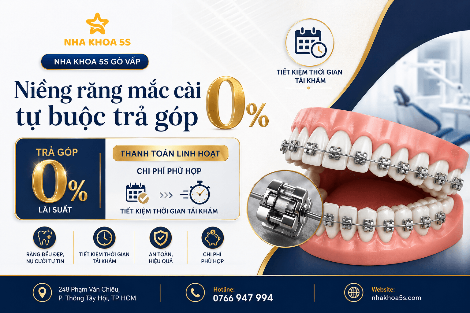 Bảng giá niềng răng trả góp 0 lãi suất và kinh nghiệm chọn nha khoa