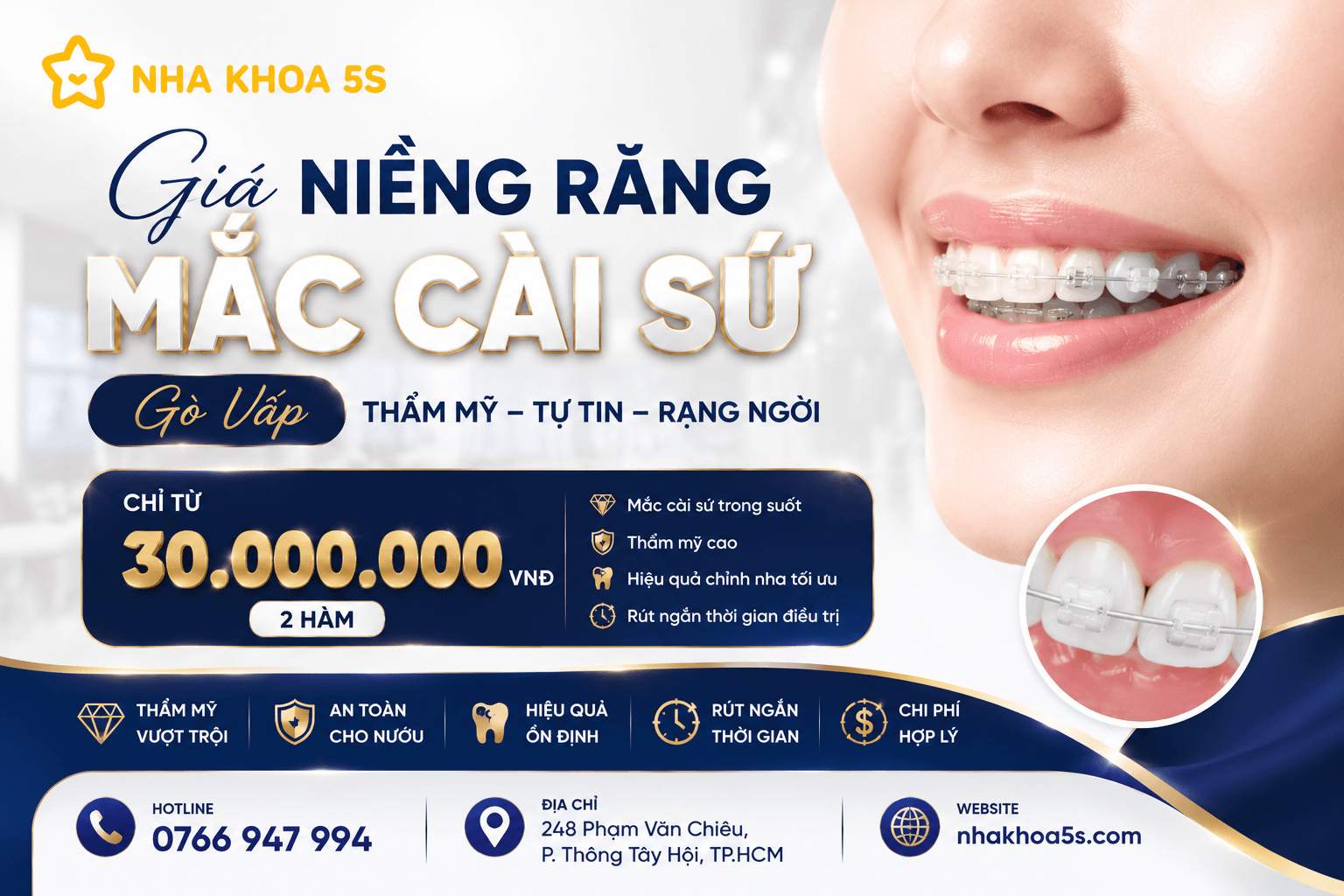 Giá niềng răng mắc cài Gò Vấp có trả góp linh hoạt